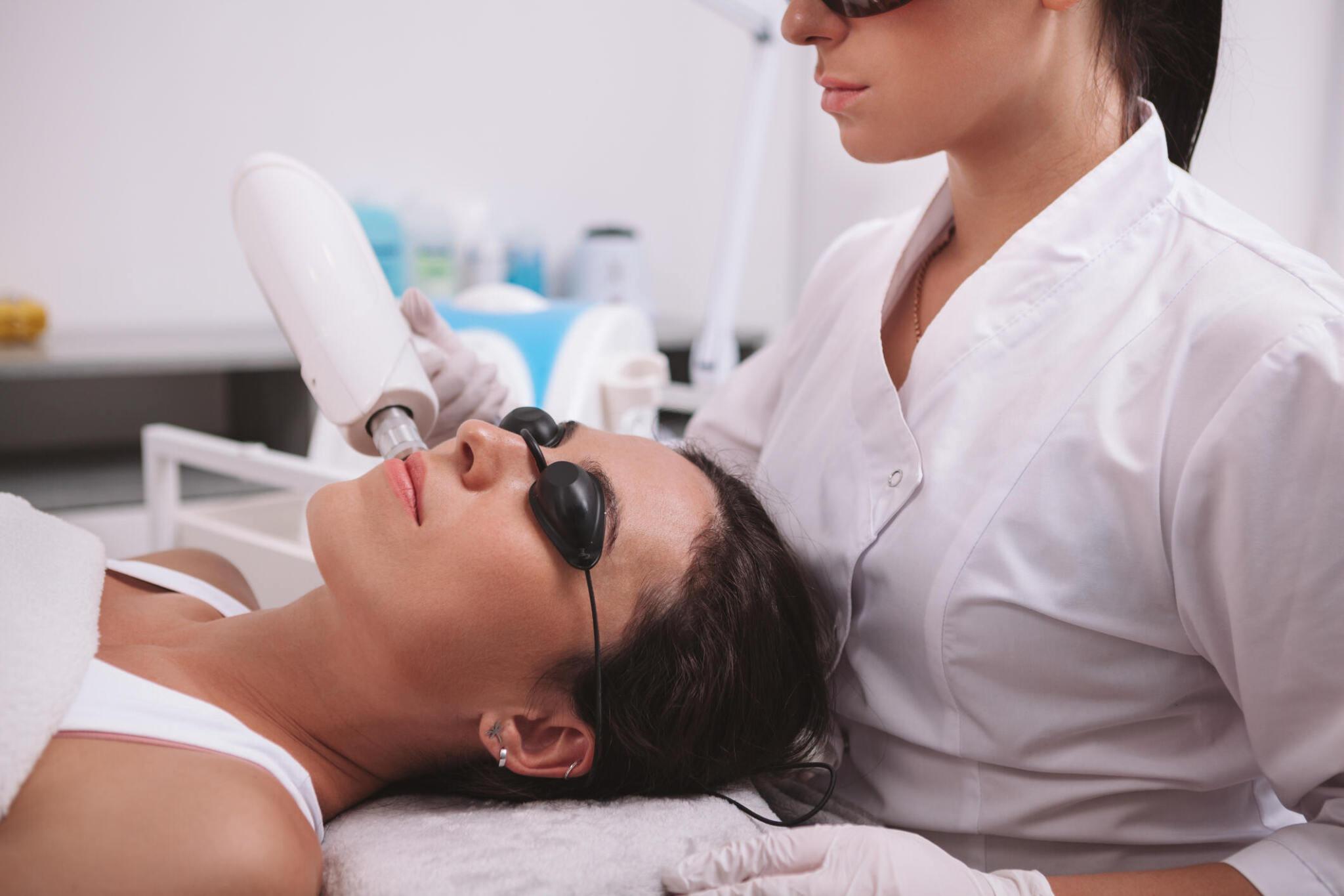 face and cheek laser hair removal